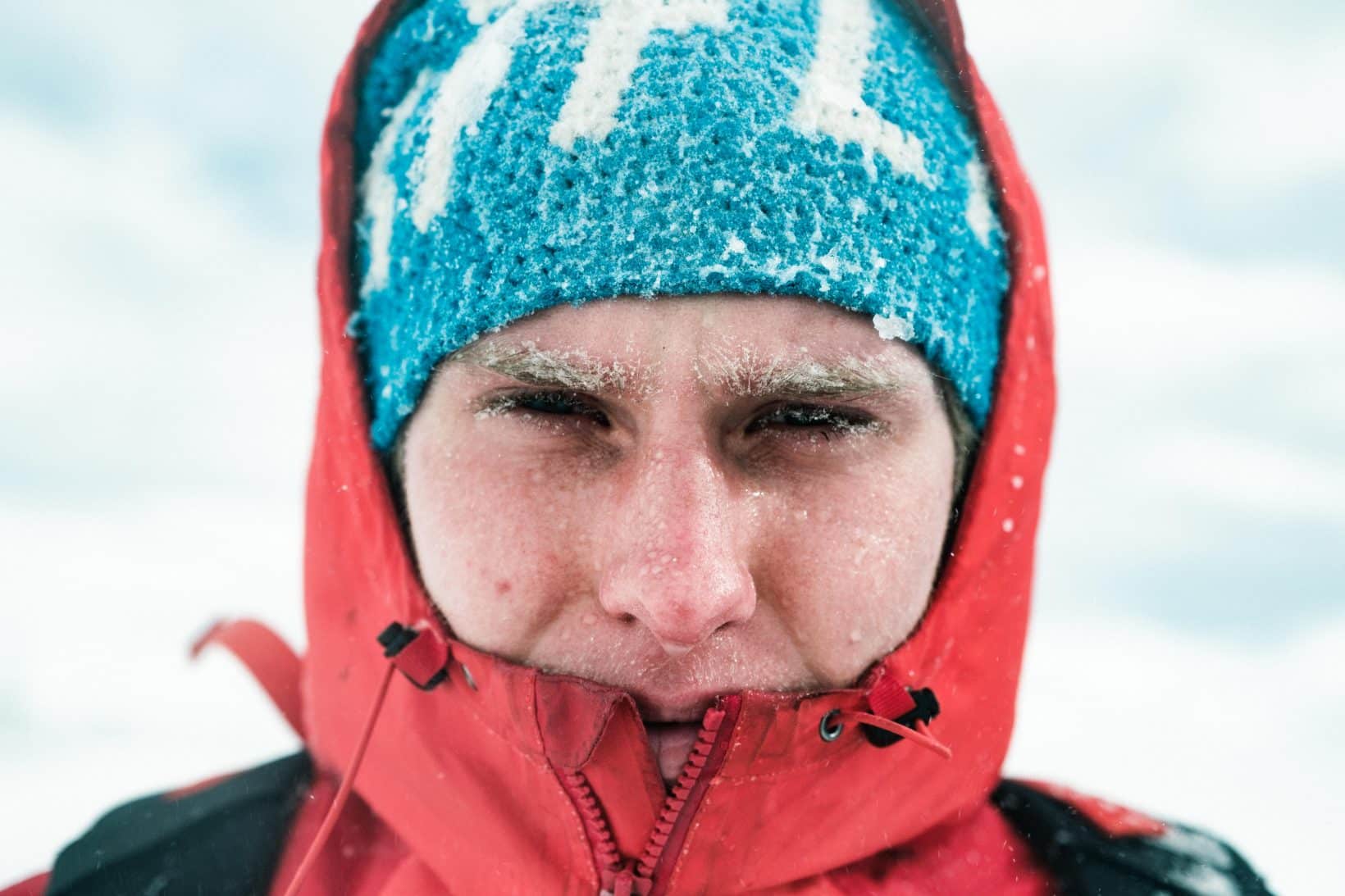 Hvordan behandle overfladiske frostskader - Norsk Luftambulanse