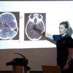 Historien om: Hjerneslag