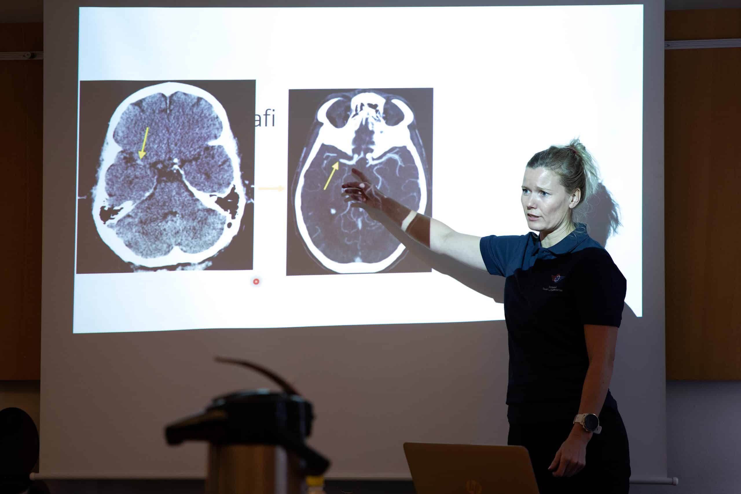 Karianne Larsen er nevrolog og forsker på om og i hvor stor grad slagambulansen har nytte for pasienter med hjerneslag.