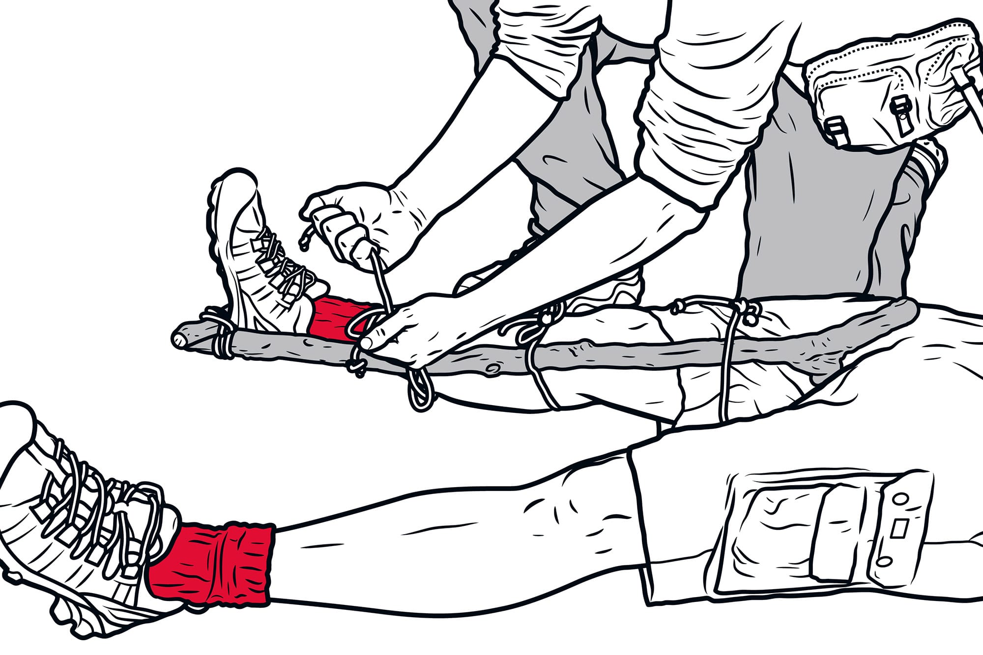 Illustrasjon av noen av stabiliserer et ben