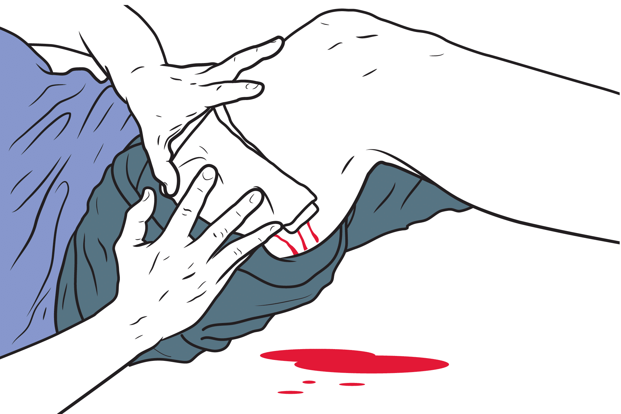 Illustrasjon av person som presser bandasje eller rent tøy mot såret ved ytre blødninger