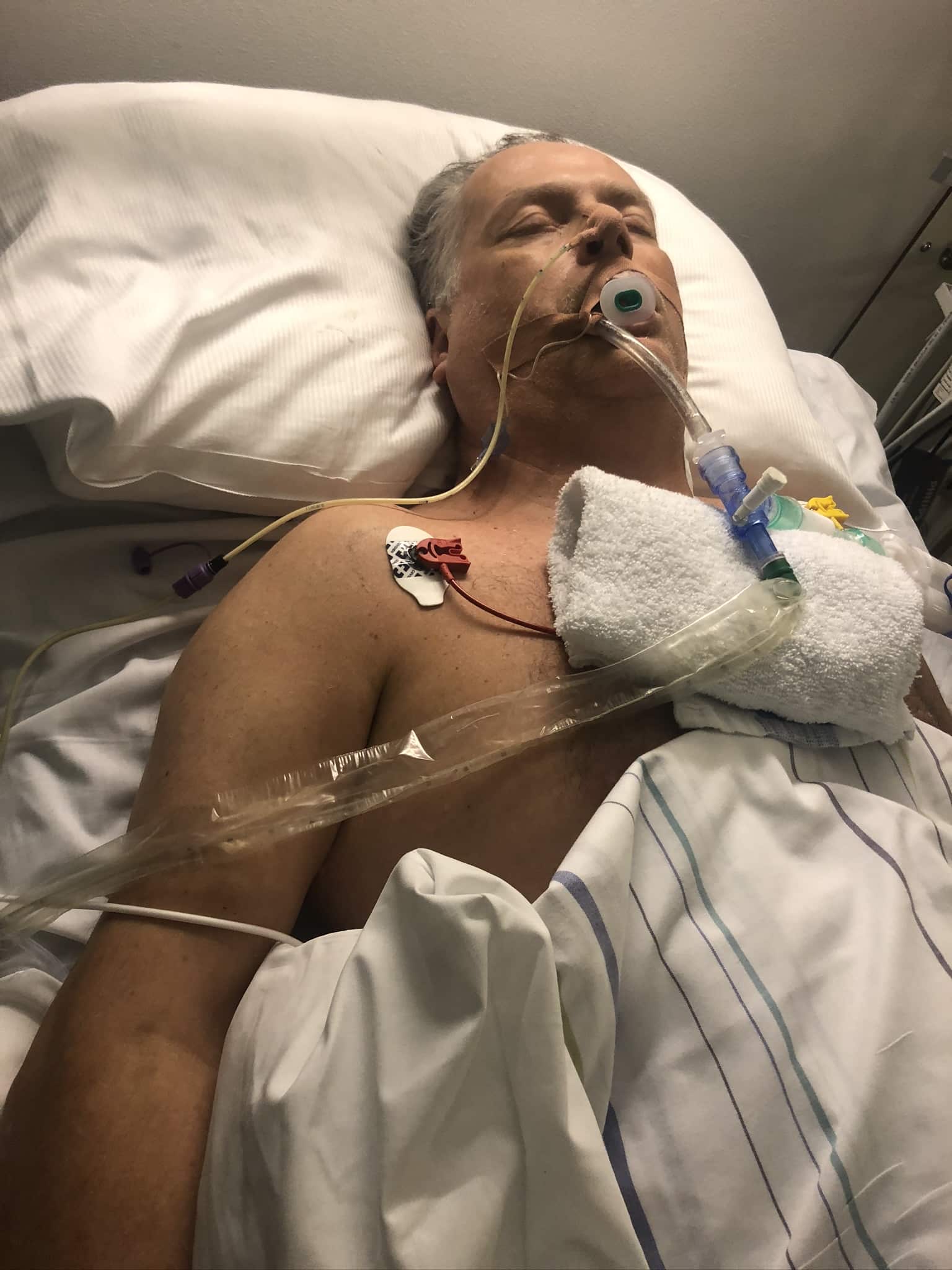 Geir Solemdal i sykehussenga. Han fikk hjerteinfarkt, hjertestans og hjerneslag. (Foto: privat)