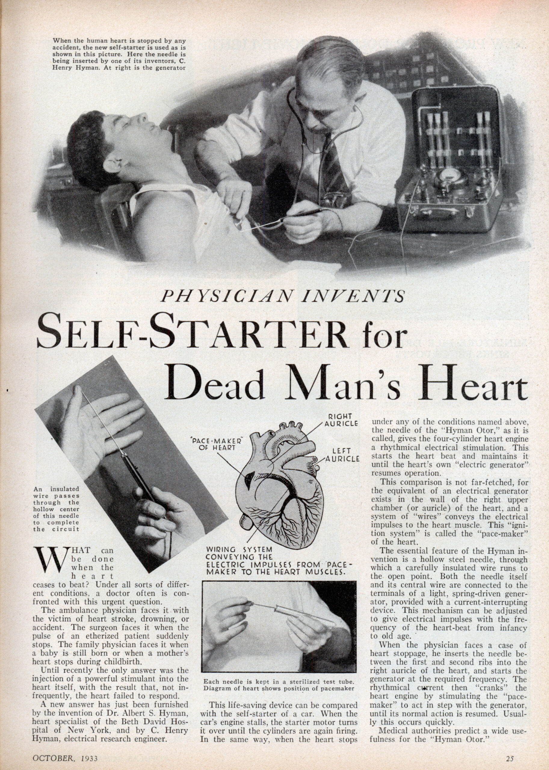 Selvstarter for død manns hjerte. En artikkel i en 1933-utgave av Popular Mechanics viser en tidlig stamfar til hjertestarteren, Hyman Otor-enheten. Historisk bilde