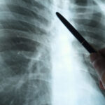 Historien om radiologi: Bildene som endret alt